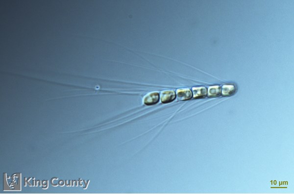 Photo of Chaetoceros subtilis